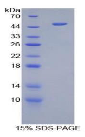 SDS-PAGE (FURIN-7820H).jpg